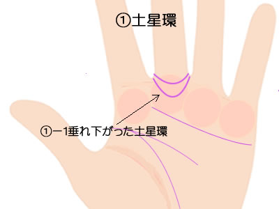 中指の下の土星環２つのパターンです。