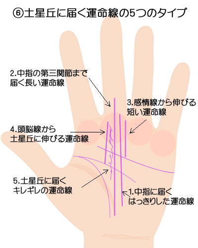 土星丘に届く運命線のパターンです。