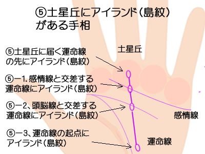 土星丘にアイランド（島紋）がある手相です。