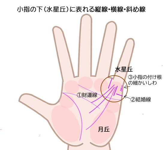 小指の下水星丘に表れる縦線・横線・斜め線の意味です。