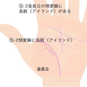 金星丘の生命線に沿って現れる情愛線に島紋（アイランド）がある意味です。