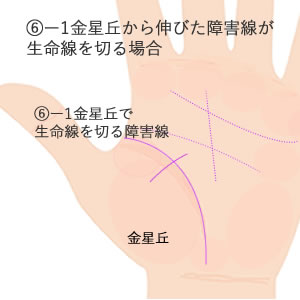 金星丘から伸びた障害線が生命線を切る場合の意味です。