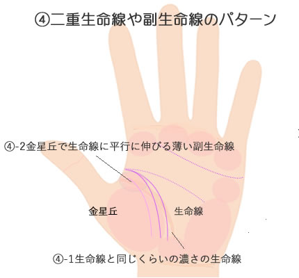 二重生命線の２つのパターンです。