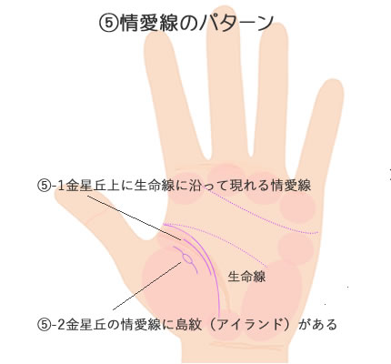 金星丘で生命線に沿ってでる情愛線２つのパターンの意味です。