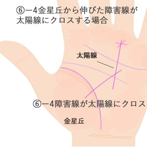 金星丘から伸びた障害線が太陽線を切る場合の意味です。