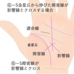 金星丘から伸びた障害線が、月丘から伸びた影響線と運命線の上でクロスしている場合の意味です。