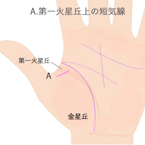 第一火星丘にあらわれる短気線の意味です。